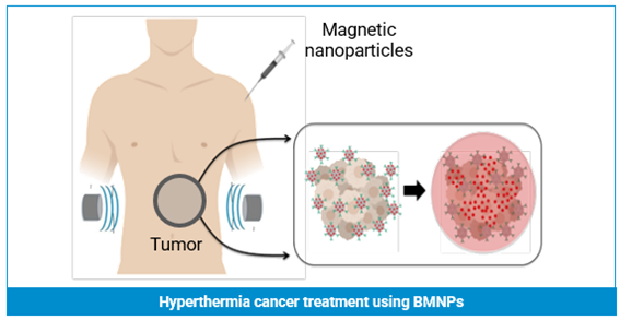Hyperthermia cancer treatment using BMNPs with magnetic nanoparticles