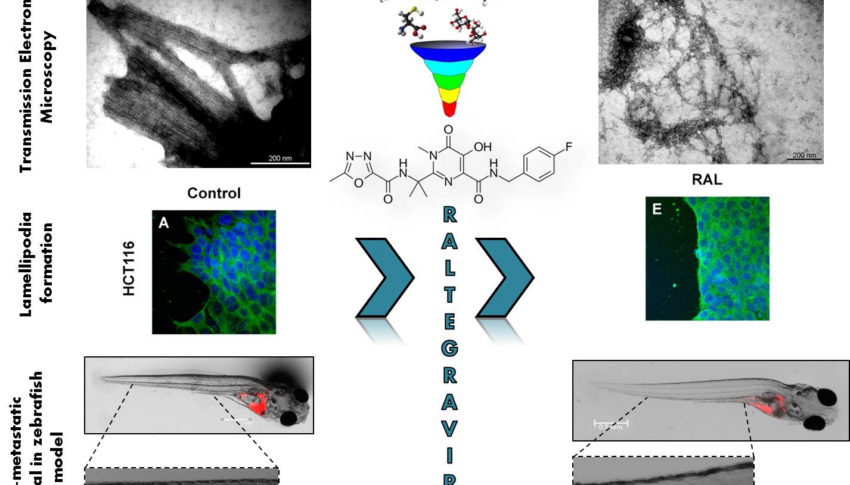 Raltegravir – therapeutic inhibitor of fascin1 in cancer