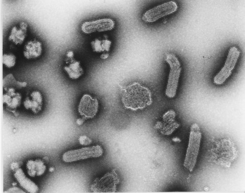 MICROTRAPS: Plasma membrane-derived vesicles to treat viral infections