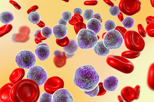 Computational system for the diagnosis of acute leukemias and lymphomas from peripheral blood images