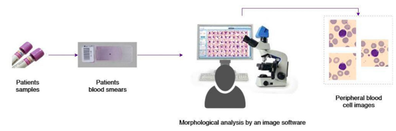 Main steps of the blood cell identification process for techtransfer