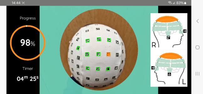 Figure 1. HeadShape app