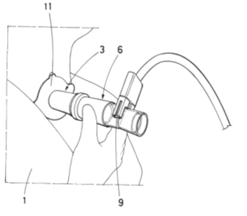Drawing of the tracheostomy adapter