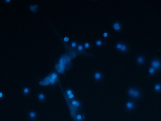 PAD4 Inhibition for NETosis-Related Diseases: A Drug Repurposing Opportunity for tech transfer